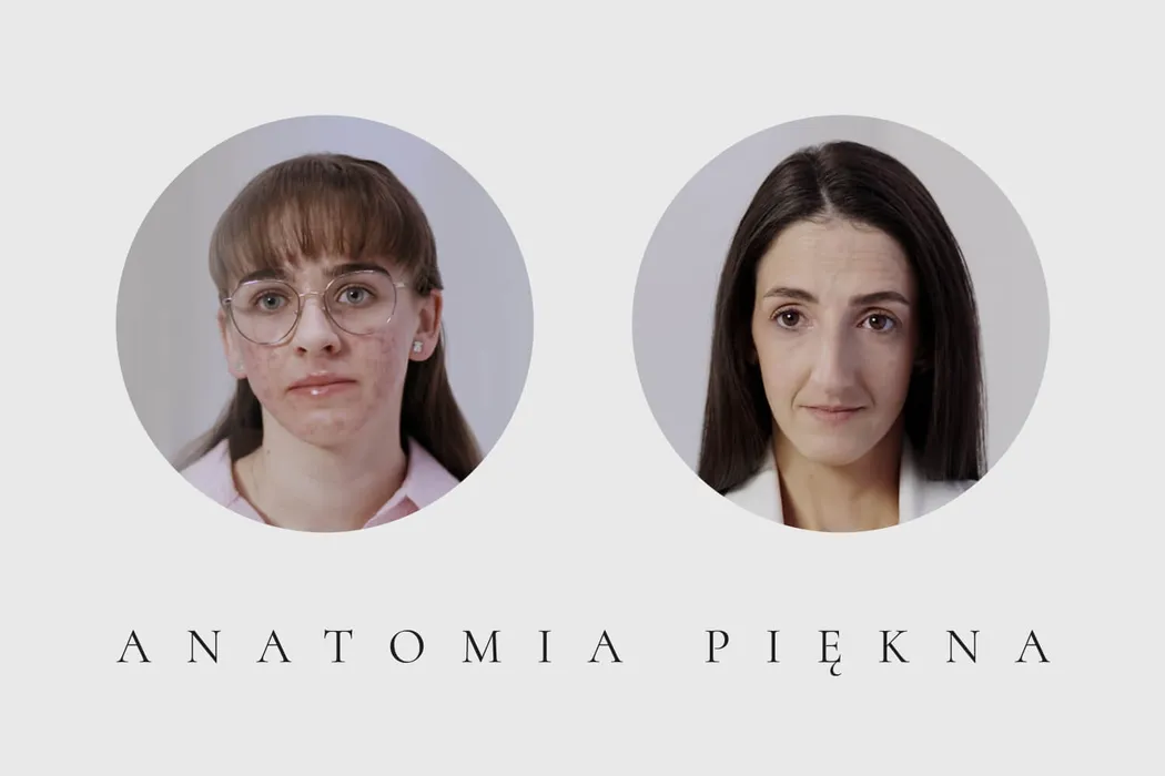 Adrianna i Natalia - uczestniczki Anatomii Piękna