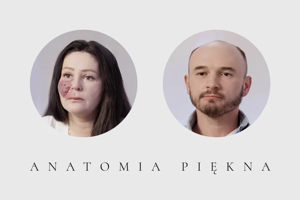 Marta i Bartłomiej - uczestnicy Anatomii Piękna